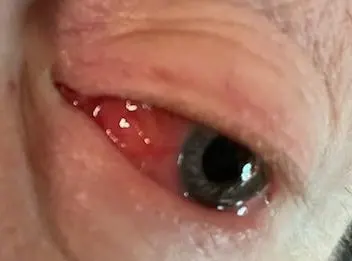 red eye photo 2