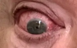 red eye photo