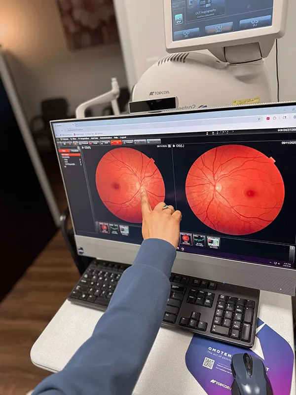 Don't lose sight of your future. Dr. Shilpa J. Patel provides state of the art management and evaluation for dry and wet AMD. She works